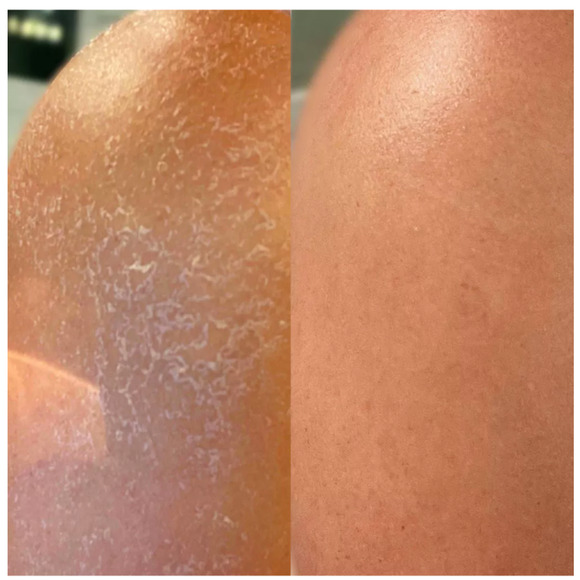 Kopari Ultra Restore Body Butter 12 fl oz (MSRP $49) - Picture 2 of 3